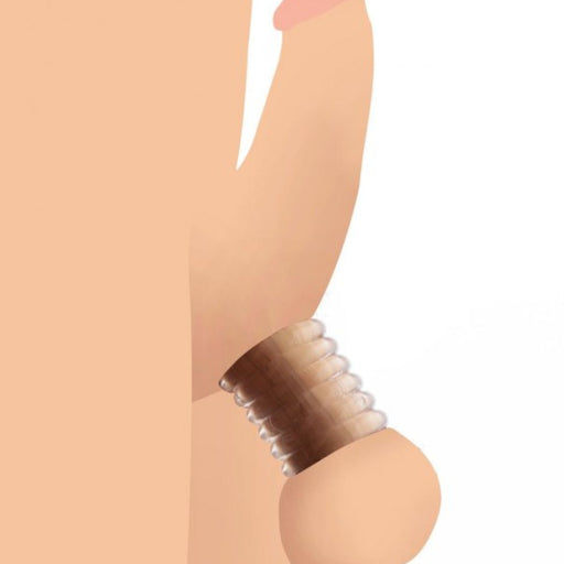 Add a Ring Custom Ball Stretcher Kit drawing of it worn on balls