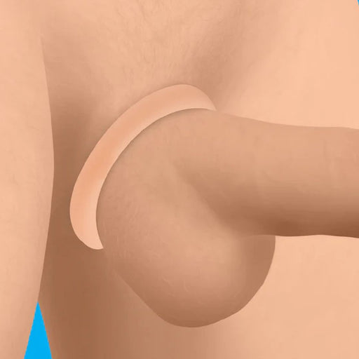 Illustration of an armpit with a small, flesh-colored, disc-shaped implant inserted into the skin. Crafted from liquid silicone, the surrounding area appears shaded to represent the natural contours of the arm. The item depicted is part of the Jock Discreet Stretchy Silicone Cock Ring Set of 3 - Vanilla by Curve Toys.